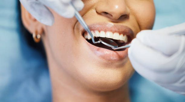 Best Same-Day Emergency Dentist in Cherry Hill, VA